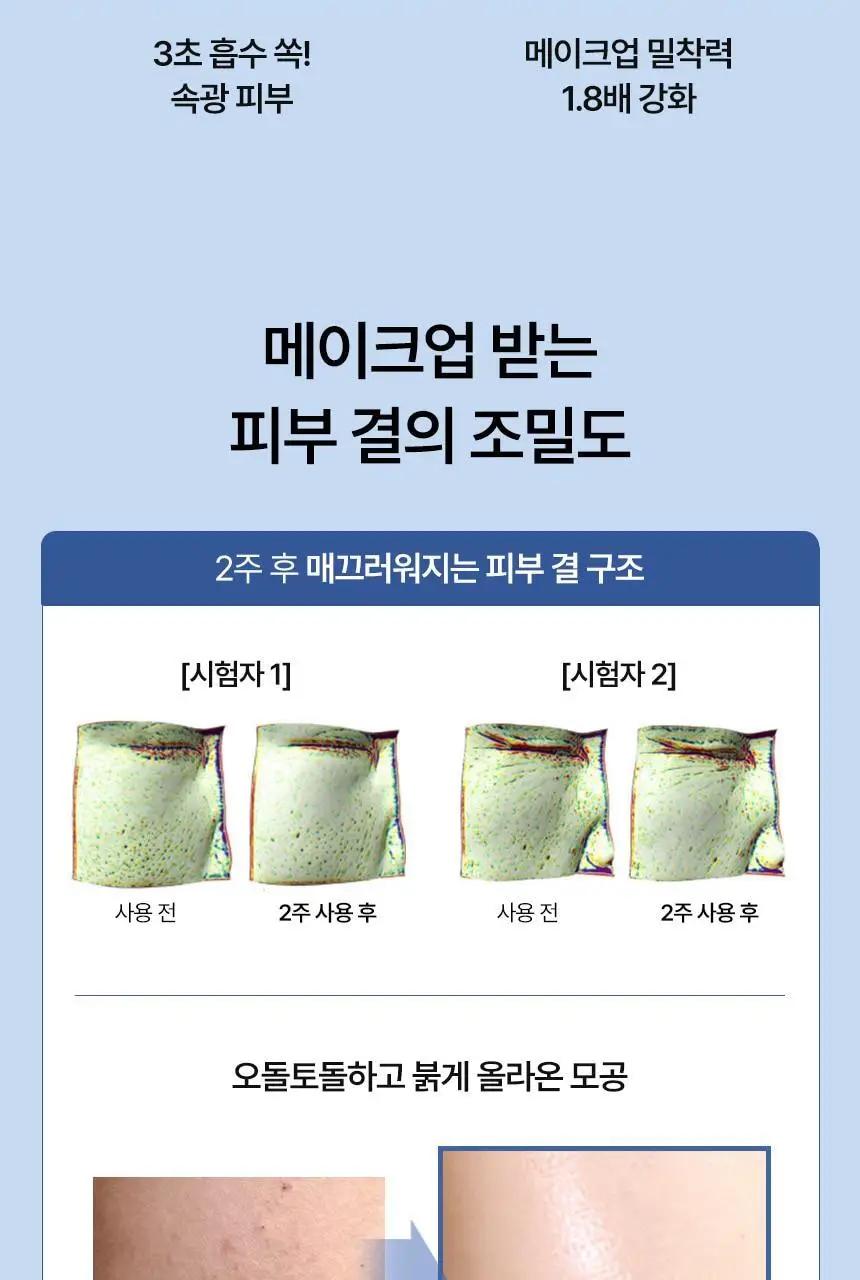 [속광화잘먹] 샤이샤이샤이 리포좀 리페어 밀키 크림 50ml 상세페이지 31